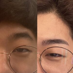 눈썹산이 살아있는 남자눈썹 교정 전후