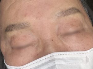 영통남자눈썹 자연스런 눈썹결로 시술 후